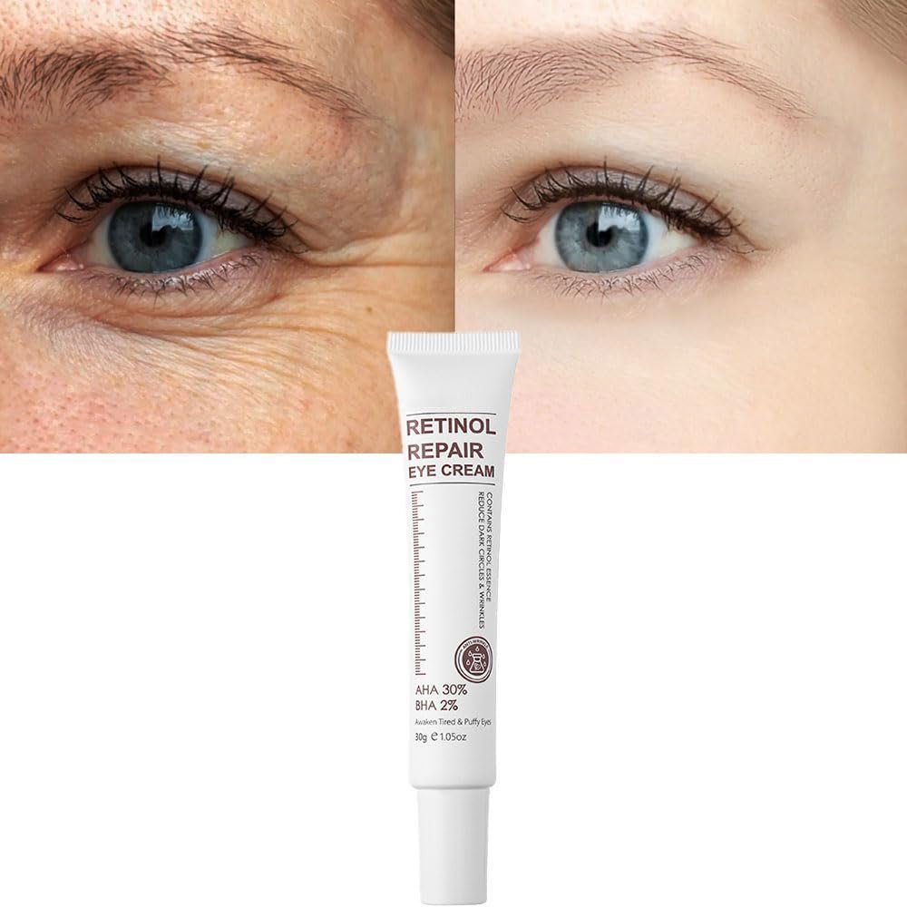 Magic Retinol Eye Cream for Dark Circles Puffiness and Bags Under Eyes, Instant Results Firm Eye Tightener, Anti Aging Under Eye Cream for Men Women, Reduce Fine Lines Wrinkles and Age Spots – 1.06 Oz