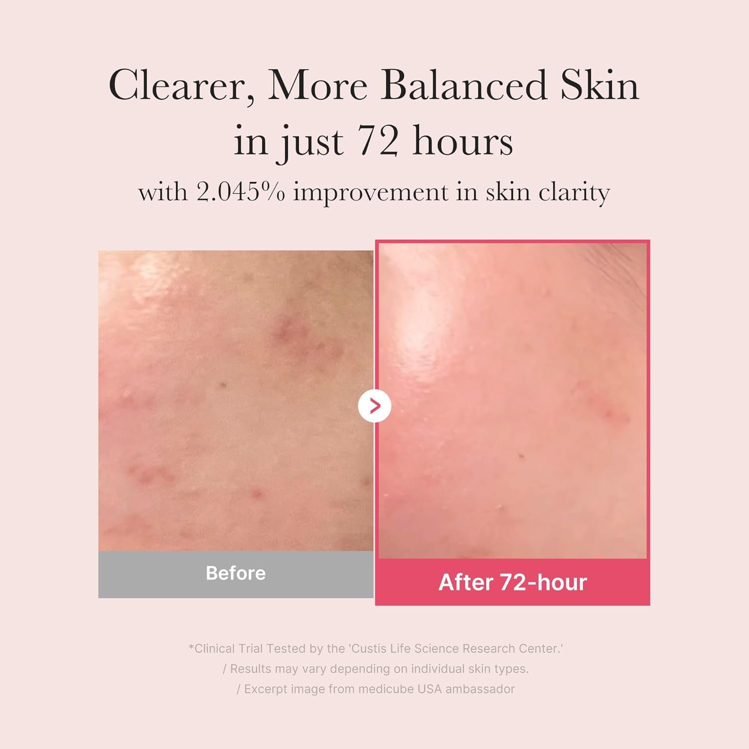 medicube Ultimate Clear Glass Skin Serum Duo: TXA + Niacinamide 15% Glow Facial Serum and PDRN Pink Peptide Serum for Uneven Skin Tone and Texture | Korean Skincare, Gifts for Women, Mother’s day