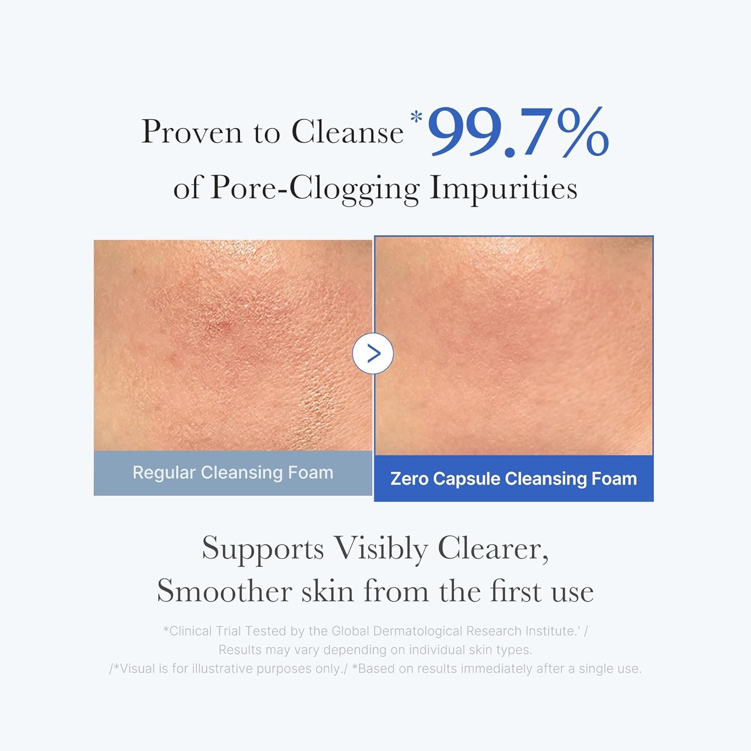 medicube Double Cleansing Duo for Facial Cleansing: Zero Pore Blackhead Cleansing Oil and Zero Pore Clear Blue Capsule Facial Cleanser | Remove Makeup, Blackheads, and Buildups