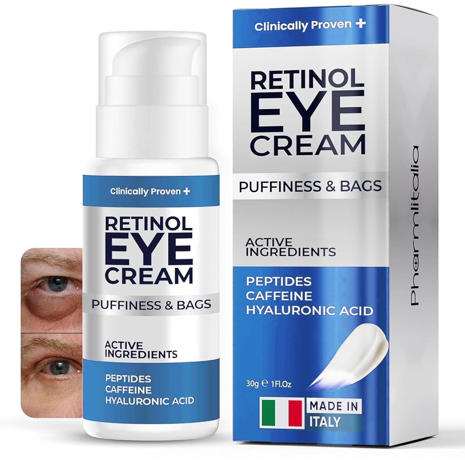 Under Eye Cream for Puffiness and Bags Under Eyes – Eye Bags Treatment for Men & Women – Anti Wrinkle Cream for Dark Circles, Baggy Eyes Treatment for Women with Retinol, Hyaluronic Acid & Caffeine